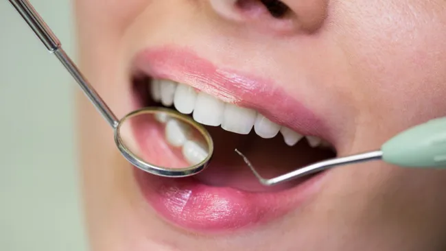 Frontiers in Oral Health: заболевания десен могут приводить к ожирению печени
