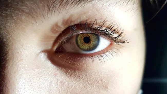 Исследование показало связь курения со старением клеток глаза