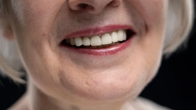 Отсутствие зубов ускоряет ухудшение памяти