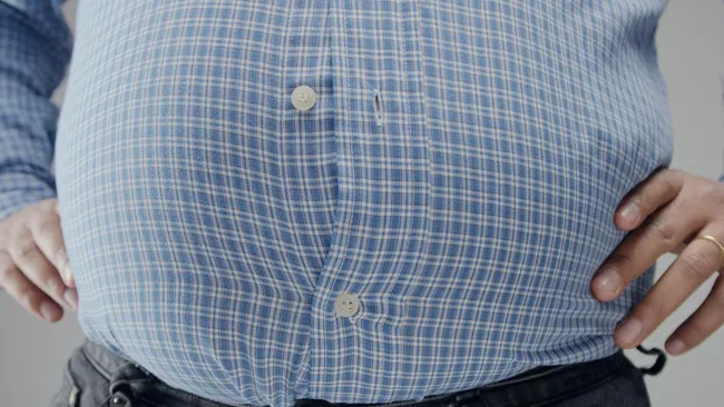 Висцеральный жир повышает вероятность развития мигрени