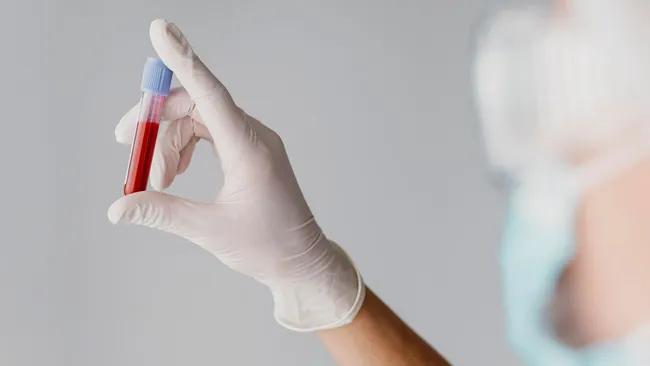 Впервые диагностированная анемия может быть предвестником рака 