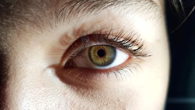 Избыток фруктозы в рационе повышает риск заболеваний глаз 