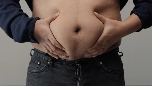 Влияние висцерального жира на развитие деменции оказалось мифом